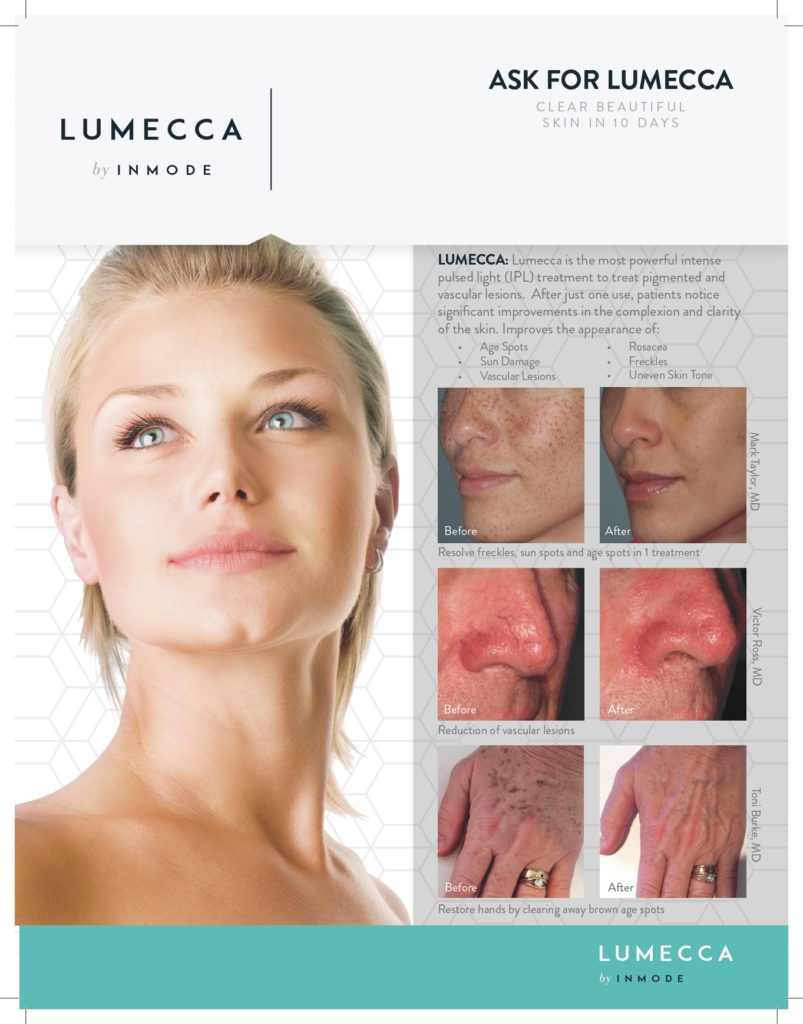Lumecca brochure with before & after images