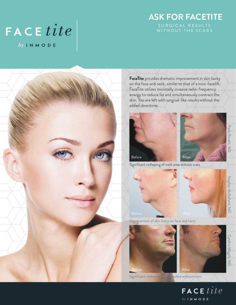 FaceTite pamphlet with before & afters