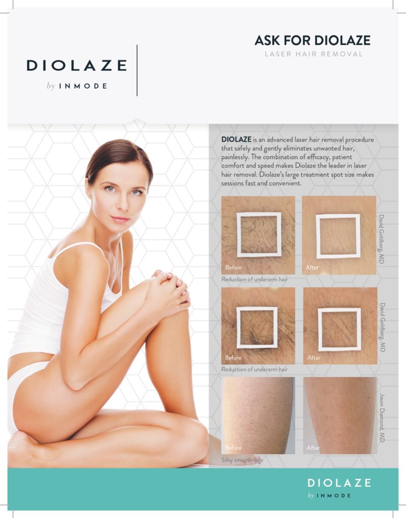 Diolaze brochure with before & after images