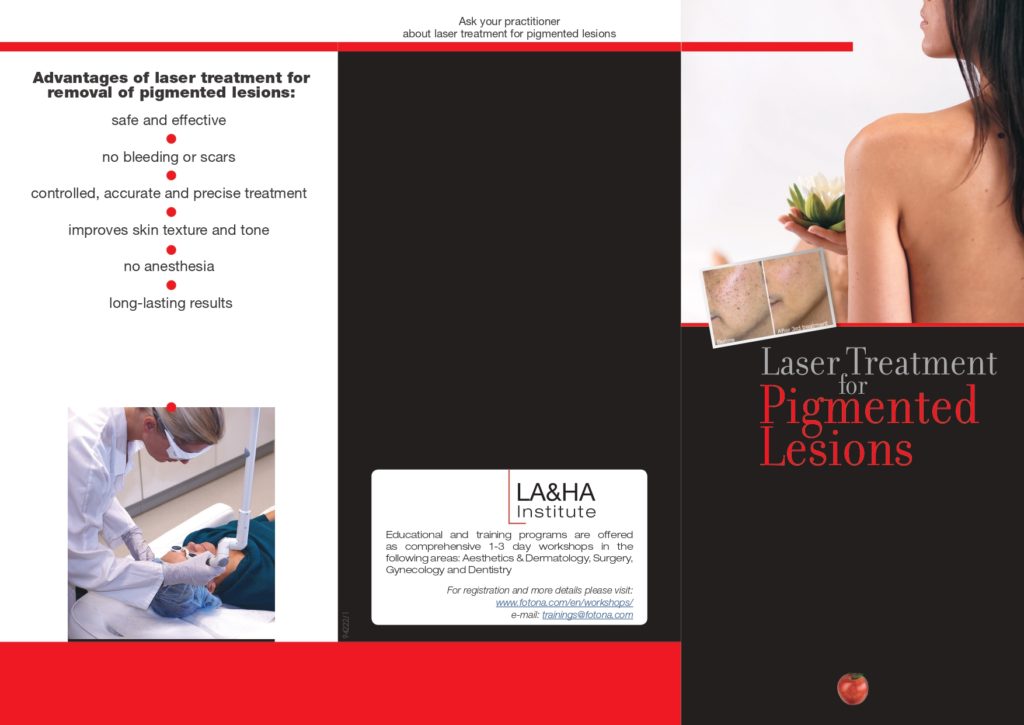 Laser treatment for pigmented lesions brochure