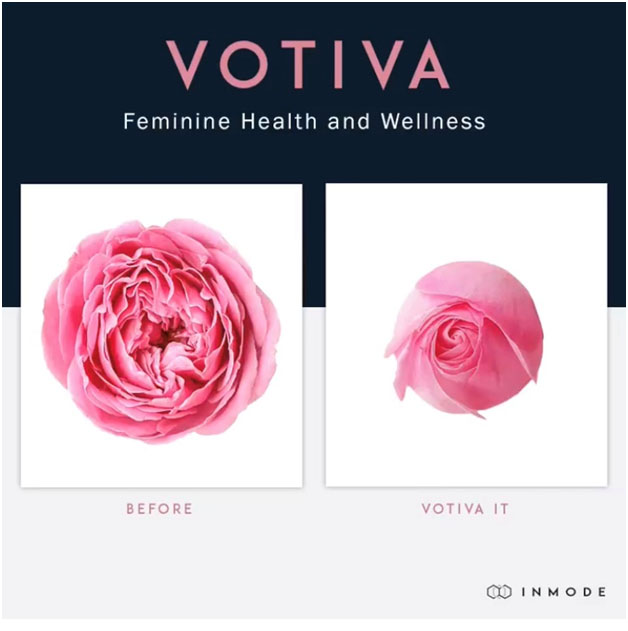 Votiva ad displaying two roses to showcase before and after procedure