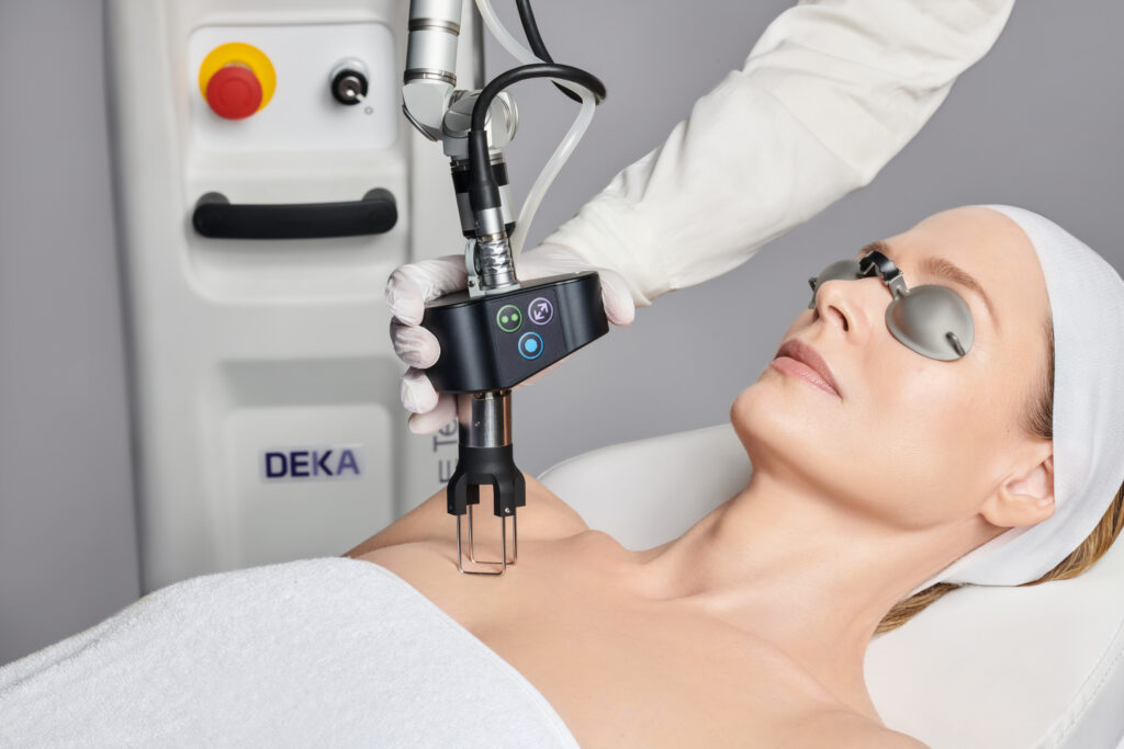 Tera CO2 Laser Treatment