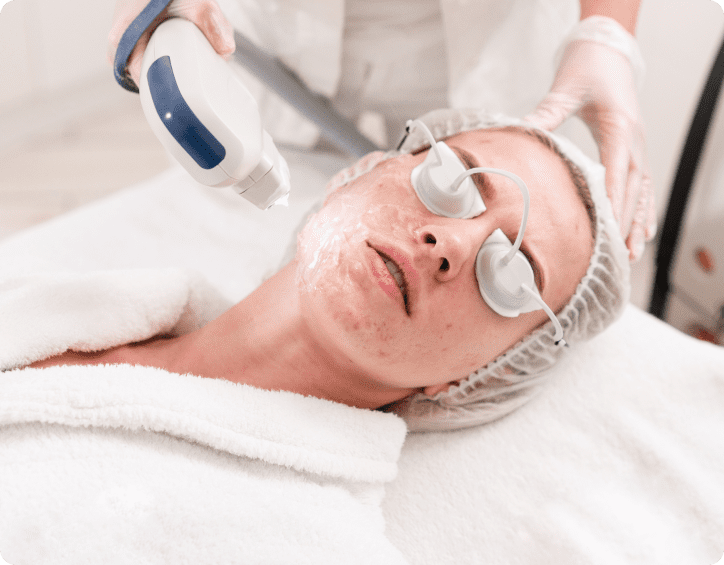 New Age Laser Clinic | Medical Spa & Laser Clinic | Laser Acne Treatment