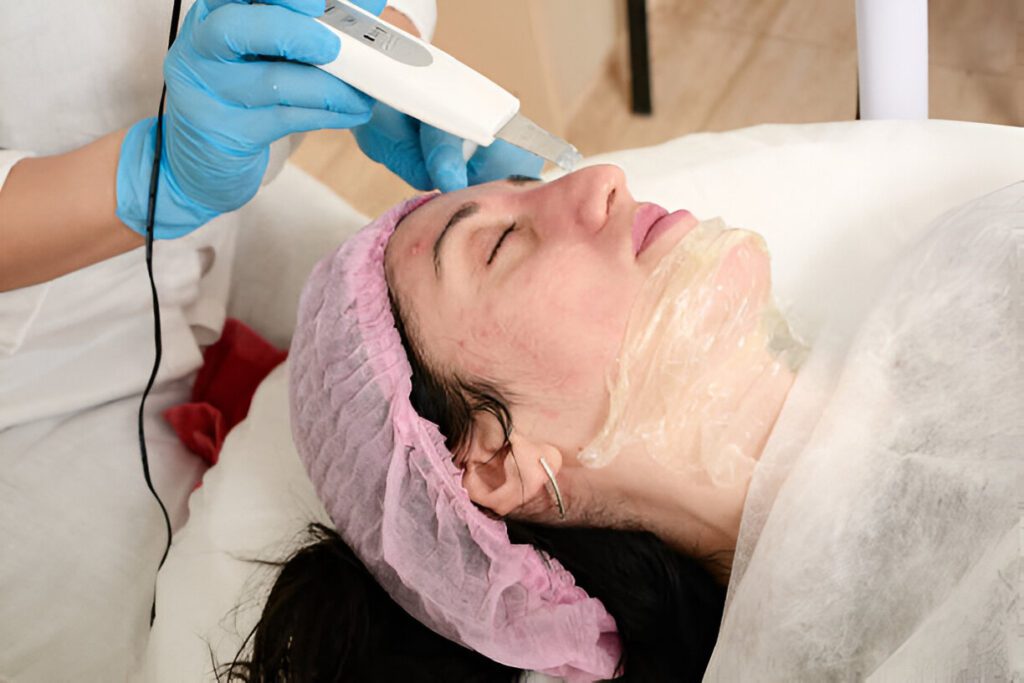 New Age Laser Clinic | Medical Spa & Laser Clinic | The Truth About Laser Acne Treatment: Myths and Facts Unveiled 